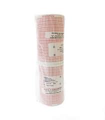 ECG Recording Paper Roll – Various – 80×30 mm
